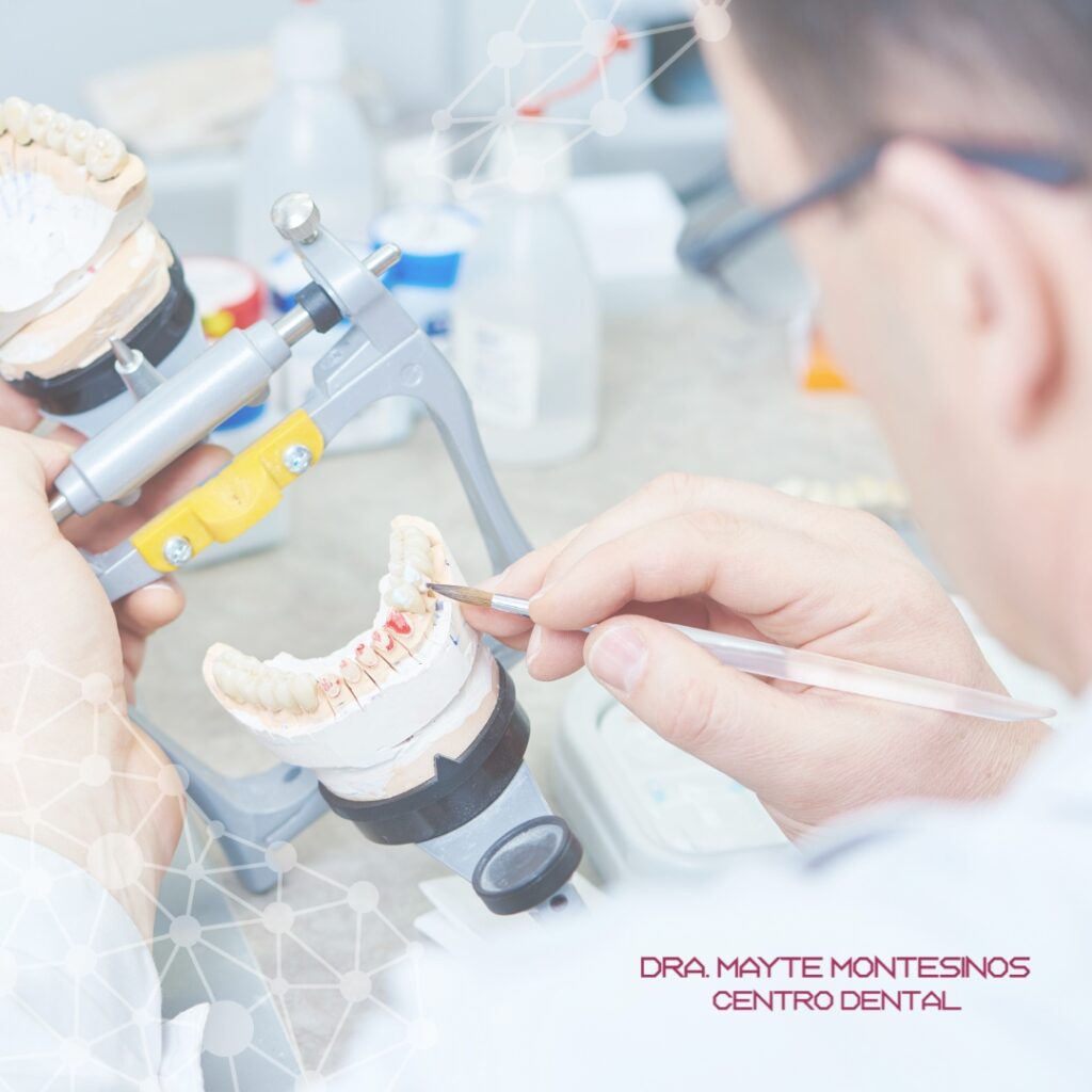 Blog Abril 24 -Centro Dental Dra. Mayte Montesinos - Dentistas en Pilar de la Horadada, Alicante