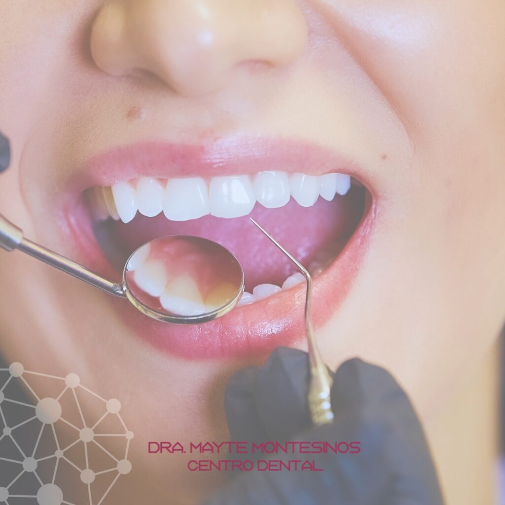 Blog- Enero 24 - Centro Dental Dra. Mayte Montesinos - Dentistas en Pilar de la Horadada, Alicante