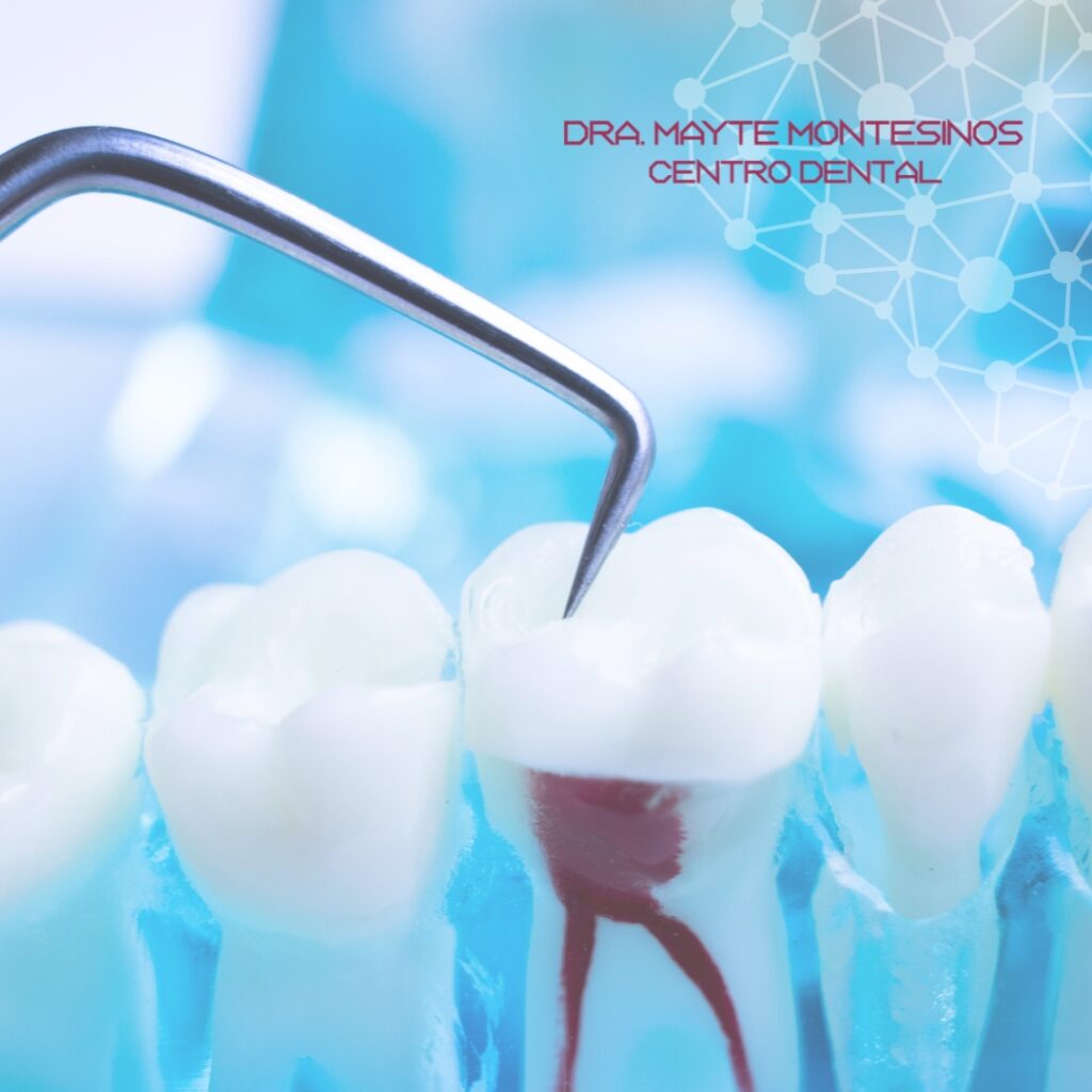 Blog- Julio - Centro Dental Dra. Mayte Montesinos - Dentistas en Pilar de la Horadada, Alicante