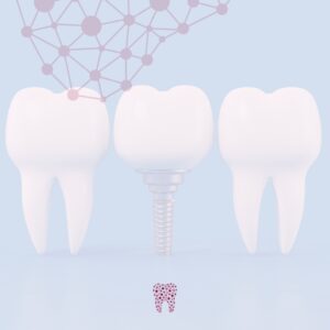 Cuidados implantes dentales