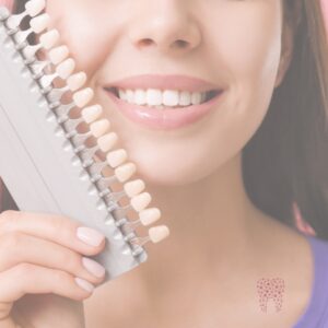 carillas dentales
